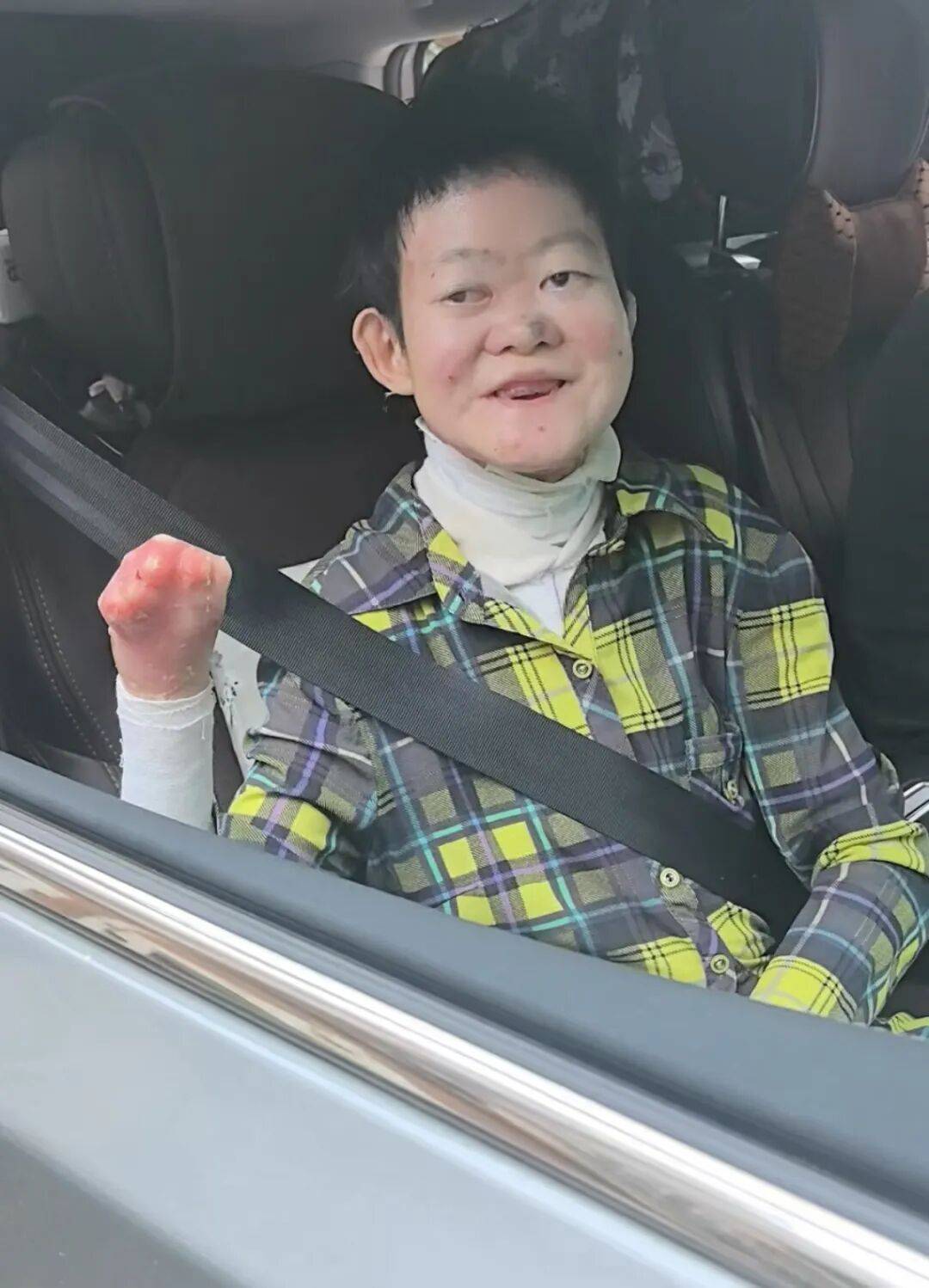 医生断言“活不过2岁”的郑州罕见病女孩<strong></p>
<p>shib币最新价格</strong>，24岁“带伤出征”，开启西藏之行