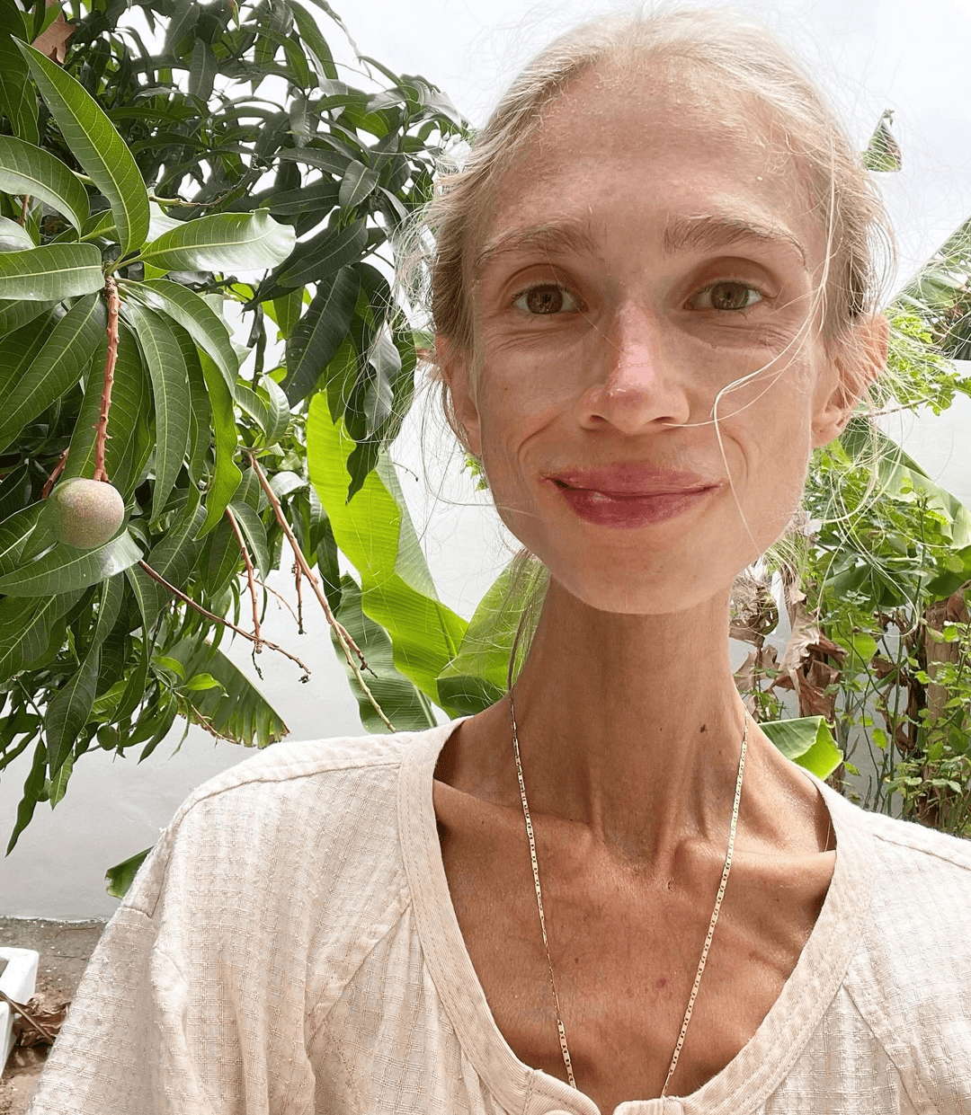 坚持只吃水果8年<strong></p>
<p>tp钱包官网下载</strong>,27岁波兰女子巴厘岛酒店去世:体重仅22公斤,指甲变黄牙齿腐烂