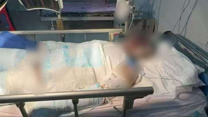 父子在哈尔滨一亲戚公司上班遇爆炸全身烧伤<strong></p>
<p>tp钱包官方网站</strong>,治疗花费近百万公司拒赔偿?亲戚回应