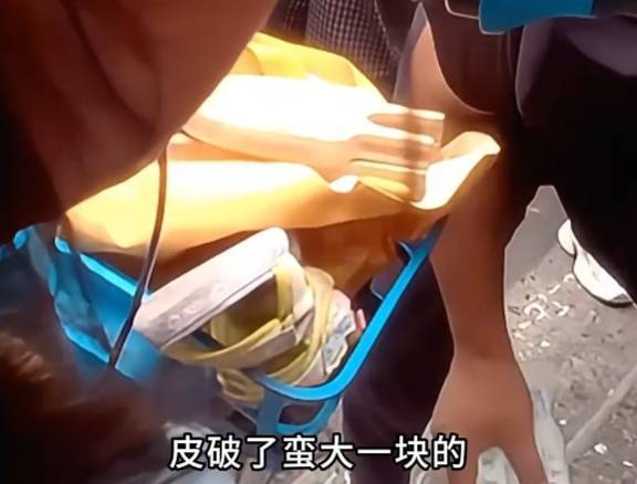 看着都疼<strong></p>
<p>tp钱包在国内合法吗</strong>!上海街头一男子突然求助:10岁女儿被死死卡住!这个行为太危险→