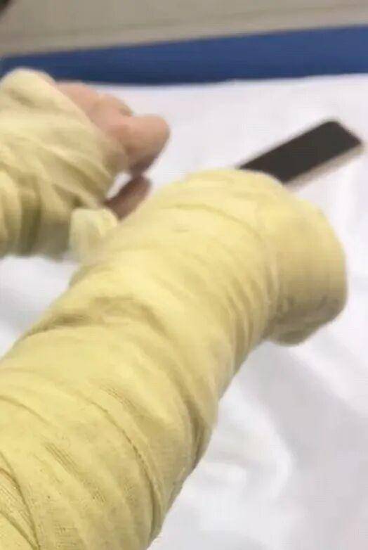 湖南一女主播被伪装的包裹炸伤<strong></p>
<p>tp钱包在国内合法吗</strong>,永州公安:正在核实具体情况