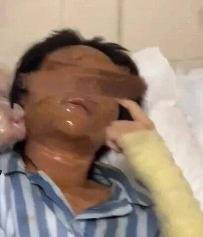 湖南一女主播被伪装的包裹炸伤<strong></p>
<p>tp钱包在国内合法吗</strong>,永州公安:正在核实具体情况