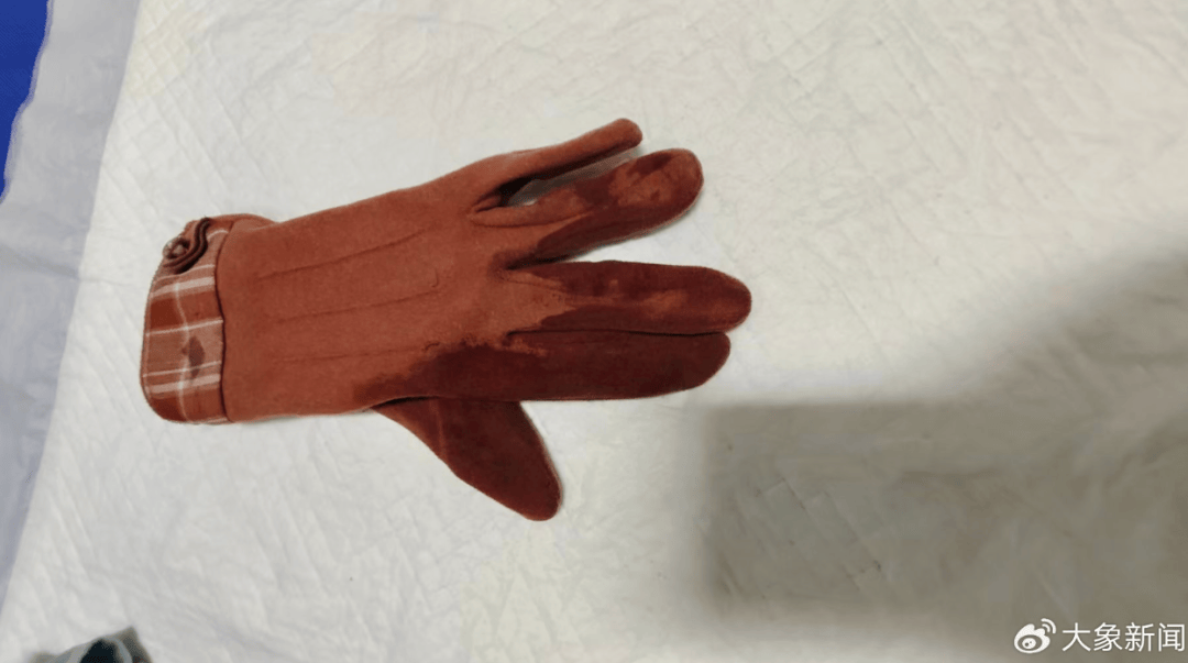 河南一男子街头挥刀乱刺<strong></p>
<p>下载比特儿</strong>，被休假女警一脚踢落凶器！女警面部缝合30余针，手套被血浸透